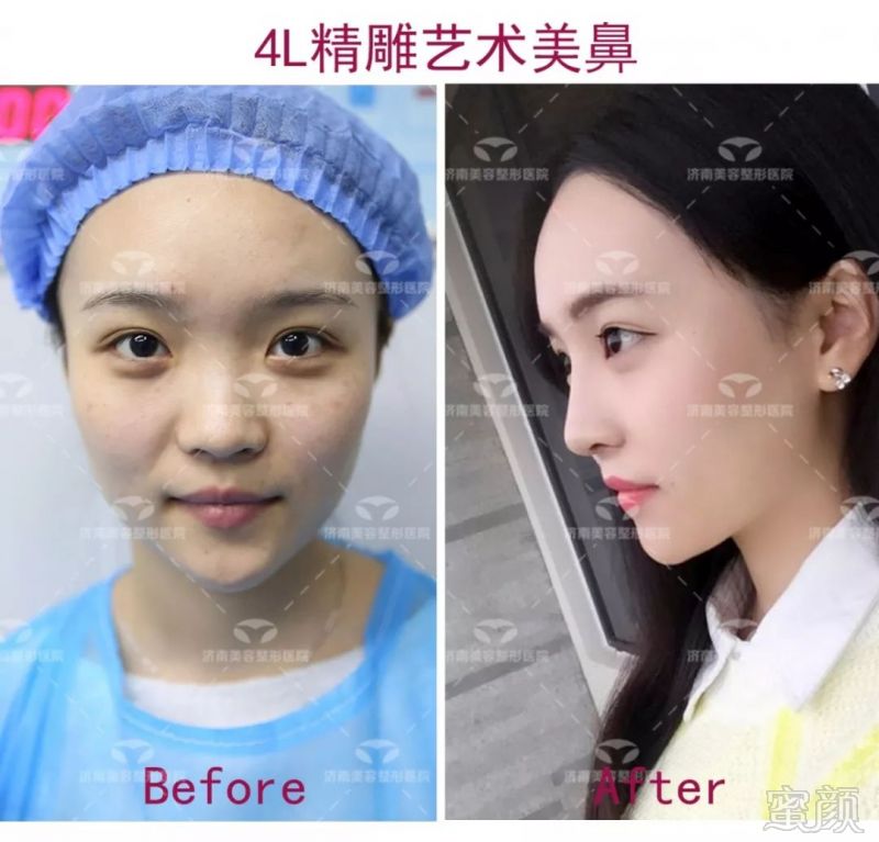 https://img.miyanlife.com/mnt/timg/180930/105G5G55-8.jpg