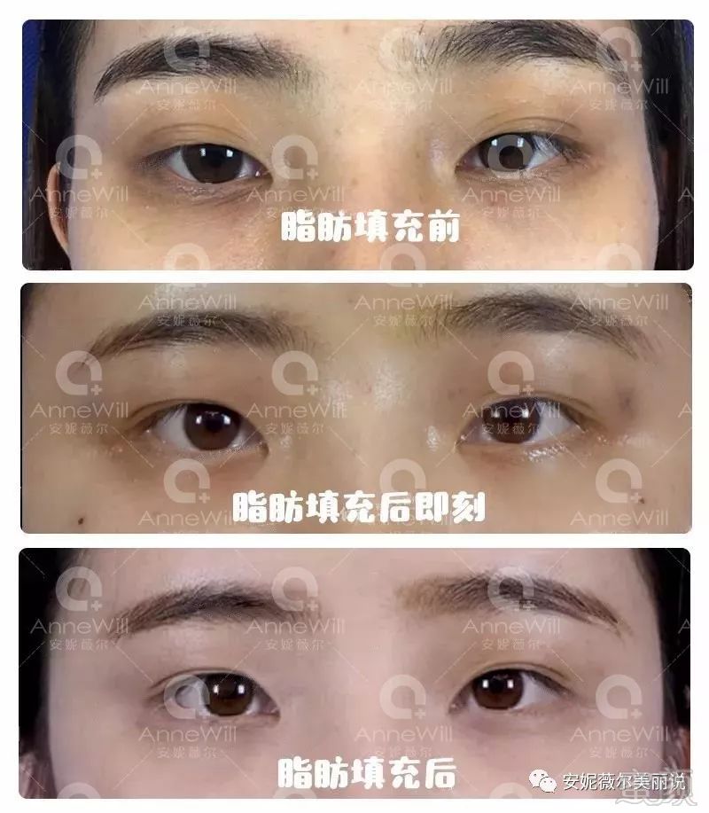 https://img.miyanlife.com/mnt/timg/180930/11113IZ1-11.jpg