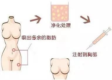 https://img.miyanlife.com/mnt/timg/180930/1121132602-0.jpg
