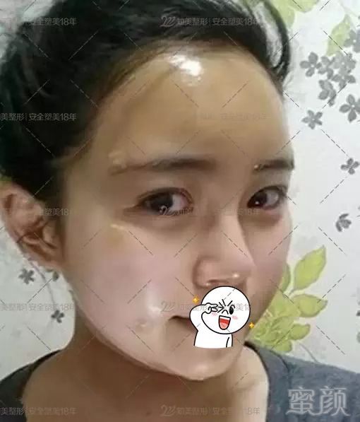 https://img.miyanlife.com/mnt/timg/180930/113354C41-2.jpg