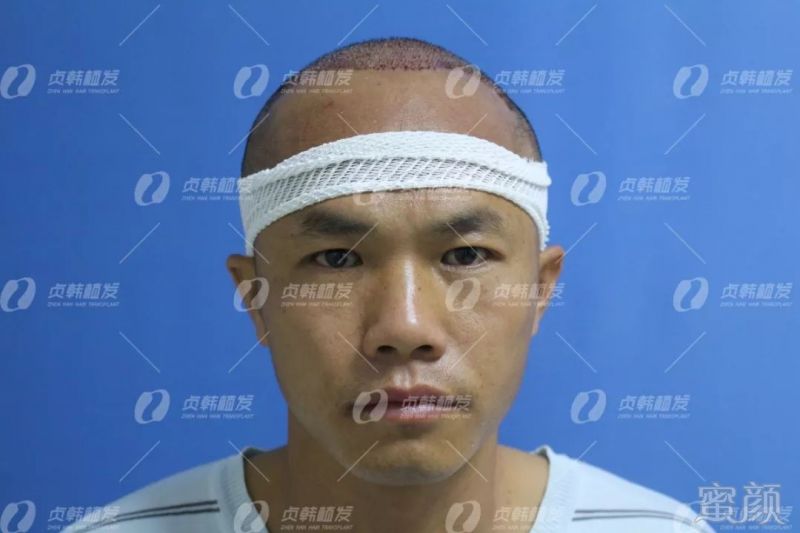 https://img.miyanlife.com/mnt/timg/180930/11540U401-8.jpg