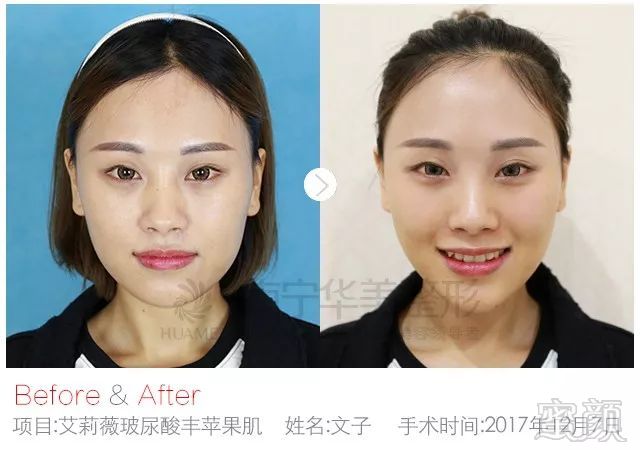 https://img.miyanlife.com/mnt/timg/180930/115UG4A-0.jpg