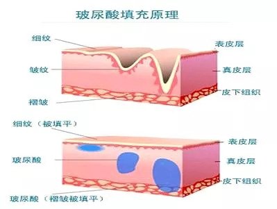 https://img.miyanlife.com/mnt/timg/180930/115UGJ5-3.jpg