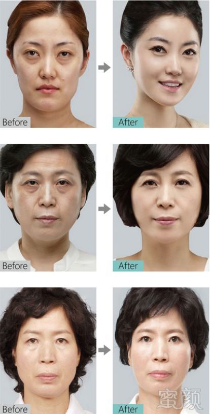 https://img.miyanlife.com/mnt/timg/180930/1202462630-10.jpg