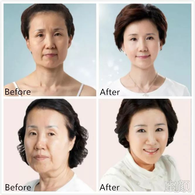 https://img.miyanlife.com/mnt/timg/180930/12024C2S-11.jpg