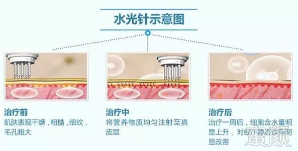 案例图片