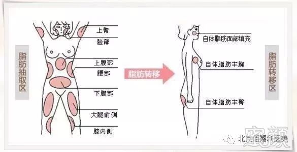 https://img.miyanlife.com/mnt/timg/180930/122U91M0-1.jpg