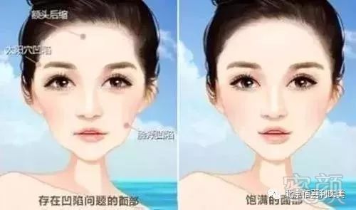 https://img.miyanlife.com/mnt/timg/180930/122U93310-2.jpg