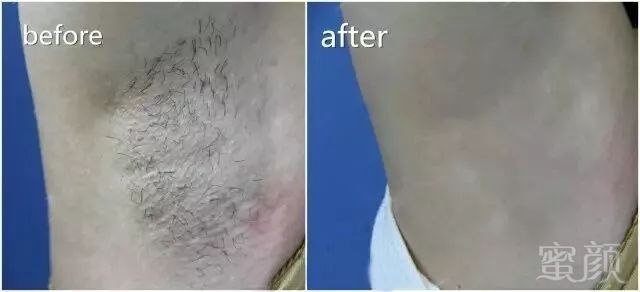 https://img.miyanlife.com/mnt/timg/180930/1230023136-7.jpg