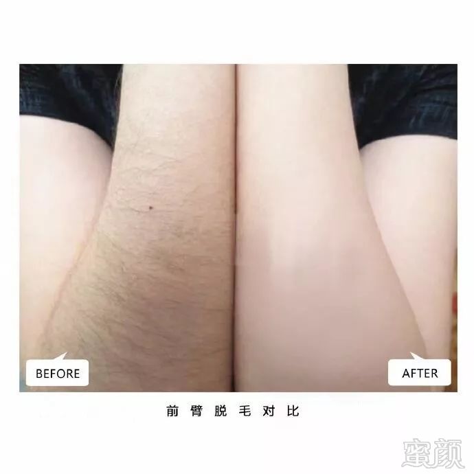 https://img.miyanlife.com/mnt/timg/180930/1230025048-5.jpg