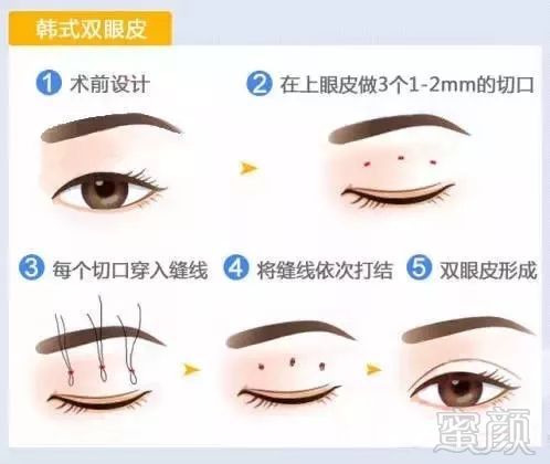 https://img.miyanlife.com/mnt/timg/180930/123I52507-6.jpg