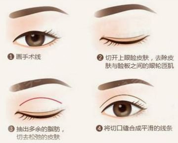 https://img.miyanlife.com/mnt/timg/180930/123I55547-7.jpg