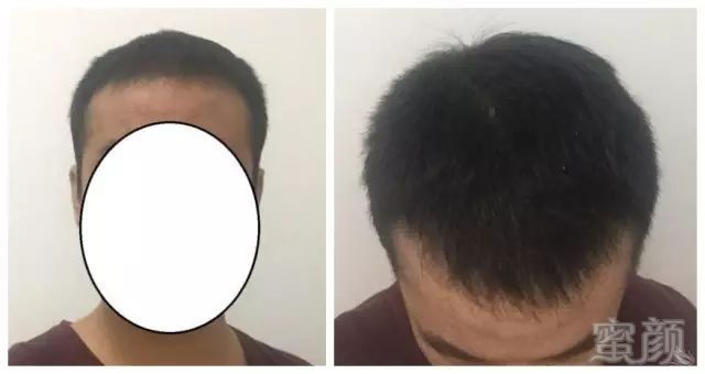 https://img.miyanlife.com/mnt/timg/180930/1241591D2-11.jpg