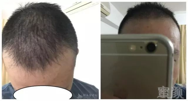 https://img.miyanlife.com/mnt/timg/180930/124159A07-9.jpg