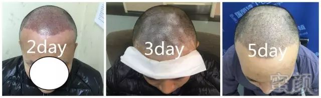 https://img.miyanlife.com/mnt/timg/180930/12415S431-6.jpg
