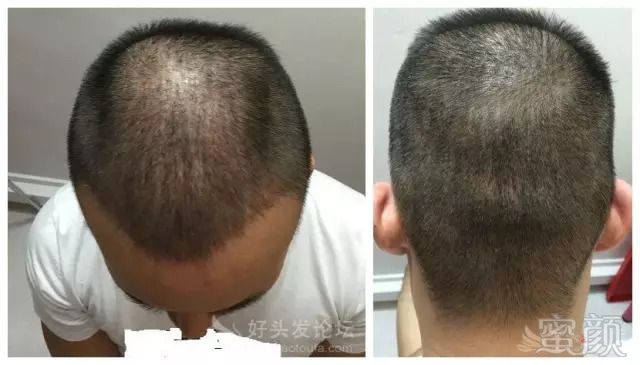 https://img.miyanlife.com/mnt/timg/180930/12415S935-7.jpg
