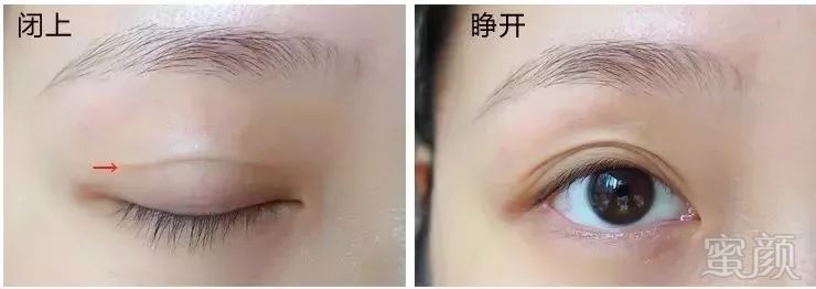 https://img.miyanlife.com/mnt/timg/180930/1245052295-7.jpg