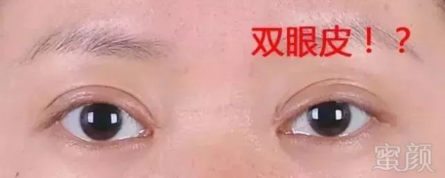 https://img.miyanlife.com/mnt/timg/180930/1245052S1-1.jpg