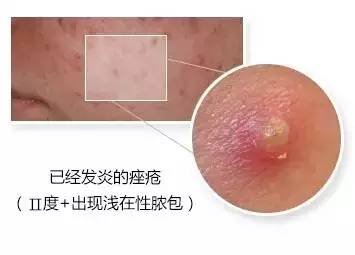 https://img.miyanlife.com/mnt/timg/180930/124R21048-14.jpg