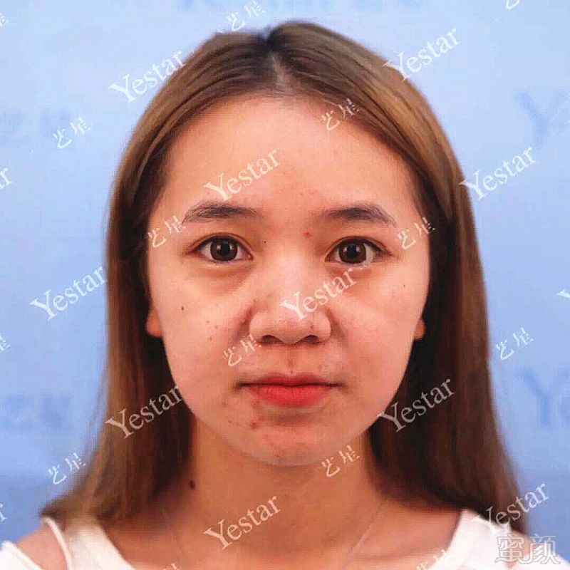 https://img.miyanlife.com/mnt/timg/180930/124R22217-5.jpg