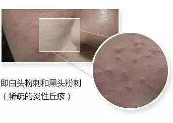 https://img.miyanlife.com/mnt/timg/180930/124R2A60-12.jpg
