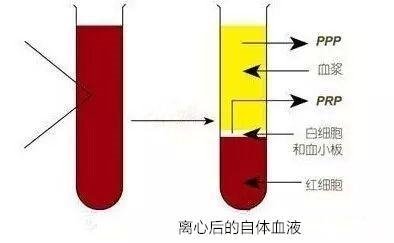 案例图片