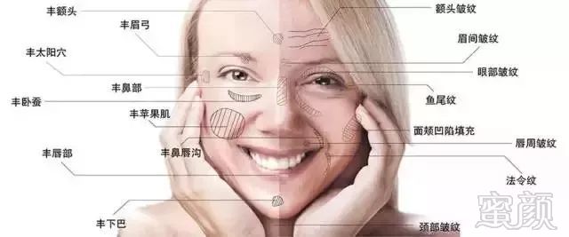 https://img.miyanlife.com/mnt/timg/181001/103H25030-2.jpg