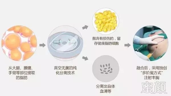 https://img.miyanlife.com/mnt/timg/181001/104J95a5-0.jpg