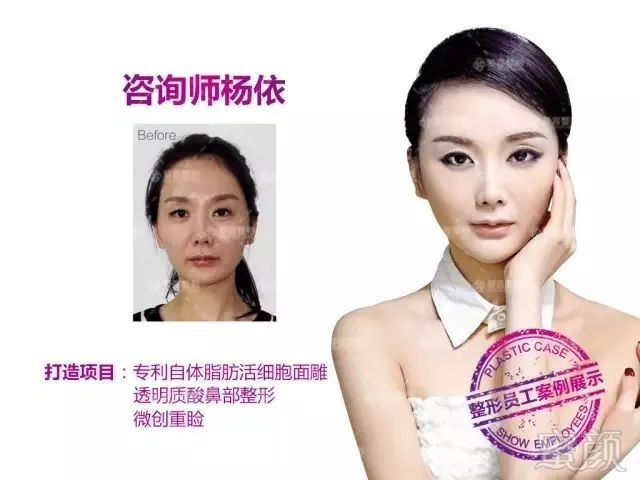 https://img.miyanlife.com/mnt/timg/181001/104K06318-7.jpg