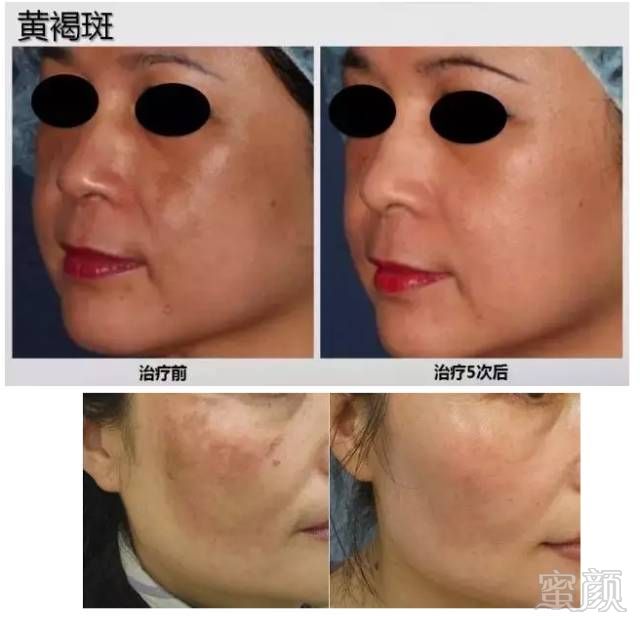 https://img.miyanlife.com/mnt/timg/181001/1052293120-10.jpg