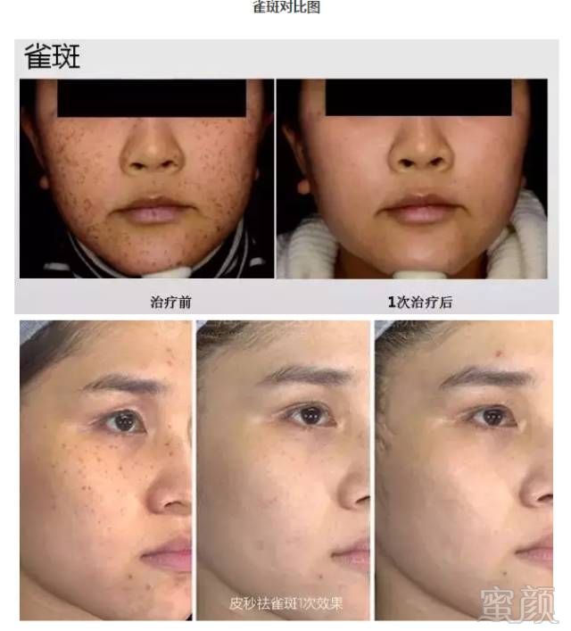 https://img.miyanlife.com/mnt/timg/181001/1052301264-12.jpg