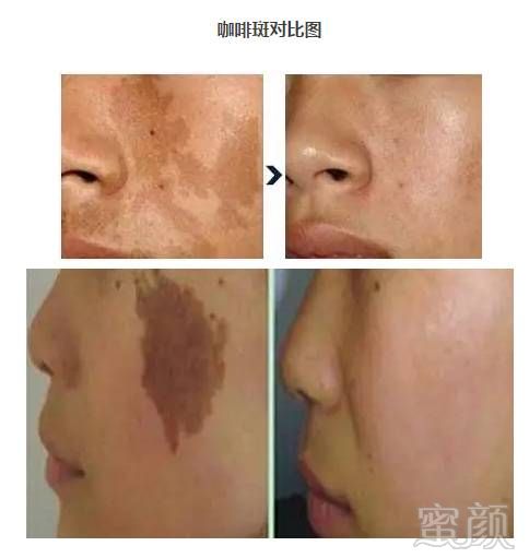 https://img.miyanlife.com/mnt/timg/181001/105230L96-11.jpg