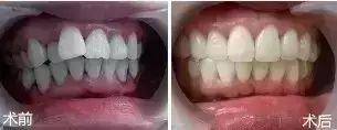 https://img.miyanlife.com/mnt/timg/181001/1102413333-14.jpg
