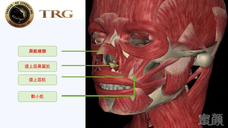 https://img.miyanlife.com/mnt/timg/181001/1104036321-2.jpg