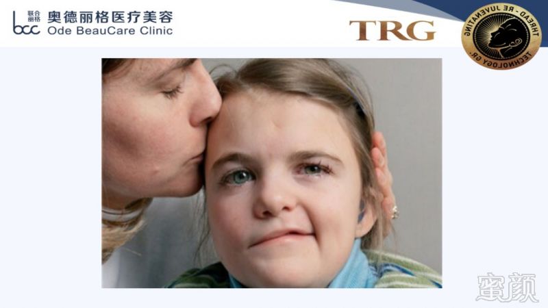 https://img.miyanlife.com/mnt/timg/181001/1104041248-3.jpg