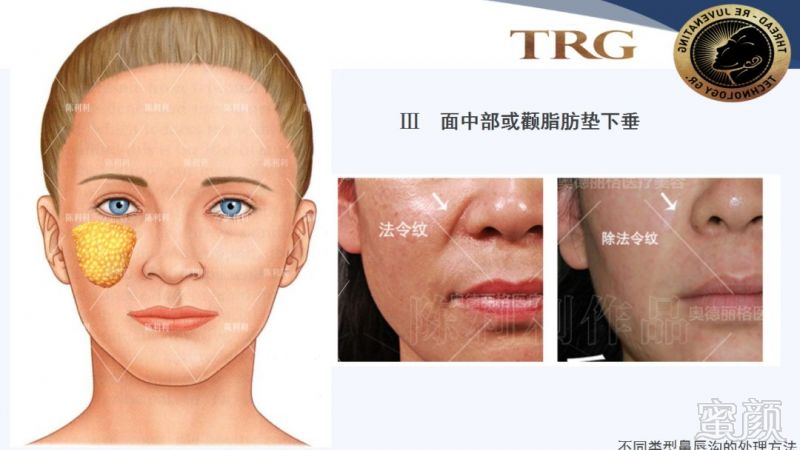 https://img.miyanlife.com/mnt/timg/181001/110404K38-4.jpg