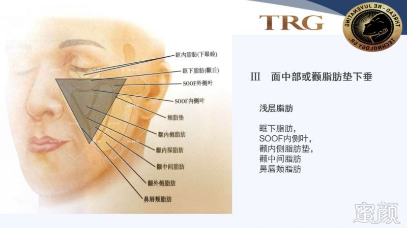 https://img.miyanlife.com/mnt/timg/181001/1104053G6-5.jpg