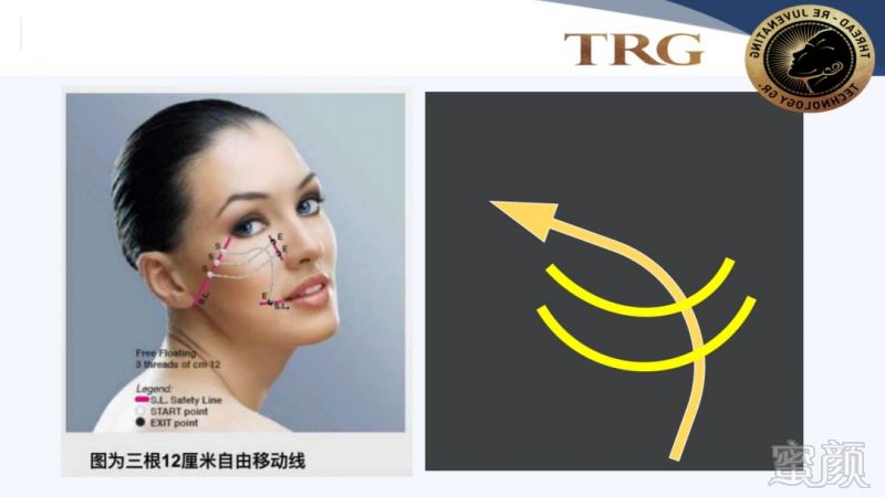 https://img.miyanlife.com/mnt/timg/181001/11040913S-10.jpg