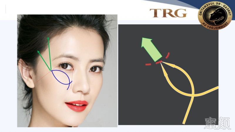 https://img.miyanlife.com/mnt/timg/181001/1104094134-11.jpg