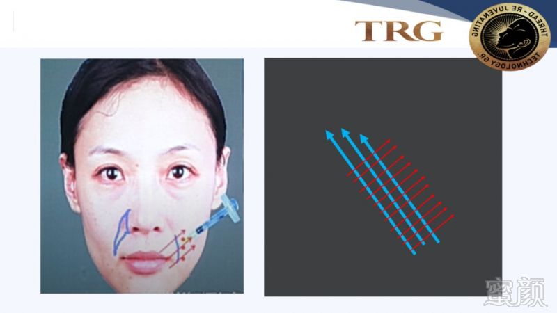 https://img.miyanlife.com/mnt/timg/181001/1104094334-12.jpg