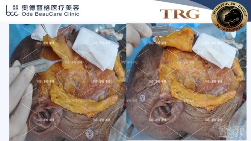 https://img.miyanlife.com/mnt/timg/181001/11040CK4-6.jpg