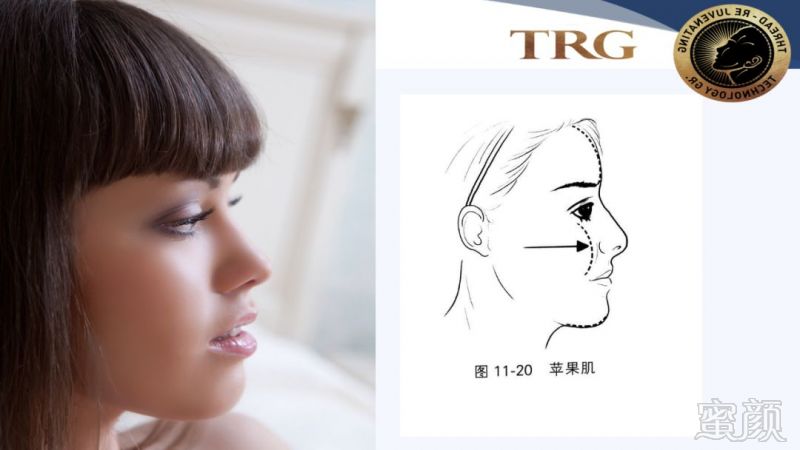 https://img.miyanlife.com/mnt/timg/181001/11040K328-7.jpg