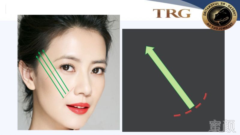 https://img.miyanlife.com/mnt/timg/181001/11040U145-9.jpg