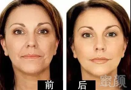 https://img.miyanlife.com/mnt/timg/181001/11133410S-3.jpg
