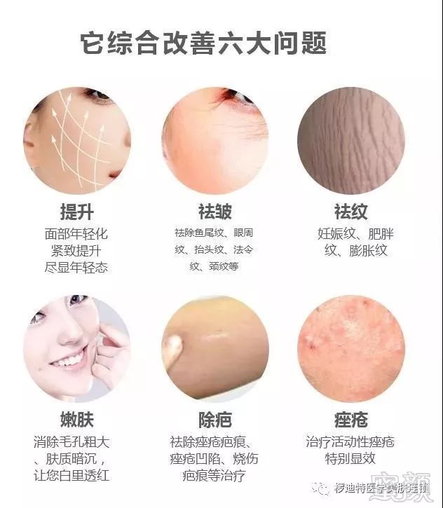 https://img.miyanlife.com/mnt/timg/181001/111644I95-2.jpg