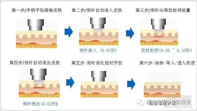 https://img.miyanlife.com/mnt/timg/181001/111644O95-3.jpg