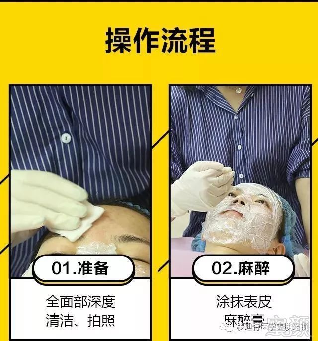https://img.miyanlife.com/mnt/timg/181001/1116452Q8-9.jpg