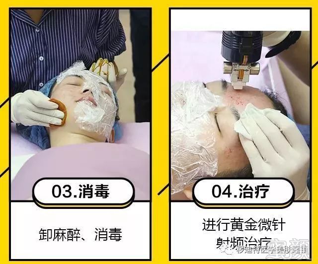 https://img.miyanlife.com/mnt/timg/181001/1116455c0-10.jpg