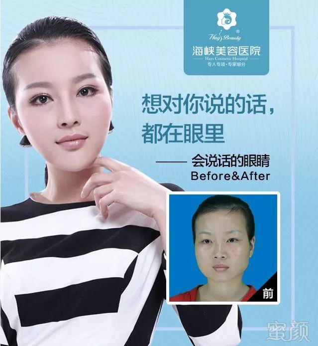 https://img.miyanlife.com/mnt/timg/181001/11293S0E-7.jpg