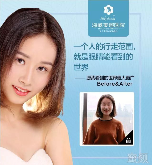 https://img.miyanlife.com/mnt/timg/181001/11293T2P-6.jpg